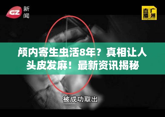 颅内寄生虫活8年？真相让人头皮发麻！最新资讯揭秘